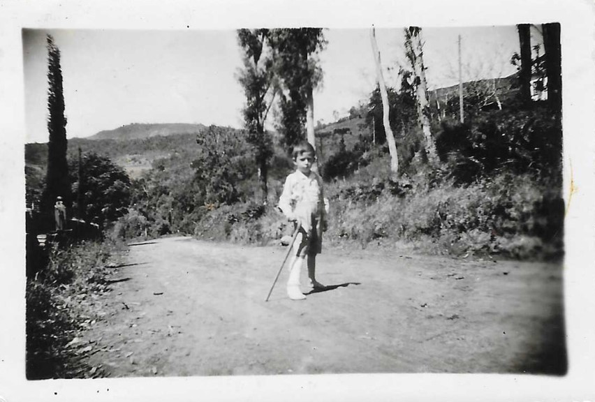Fernando Albrecht aos sete anos quando morava em São Vendelino e quebrou a perna